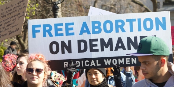 Fahriye Evcen’in Radikal Değişimi Sosyal Medyayı Salladı